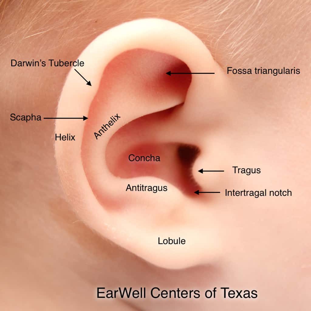 Labeled photograph of an infant's outer ear showing the helix, antihelix, scapha, fossa triangularis, concha, tragus, antitragus and lobule